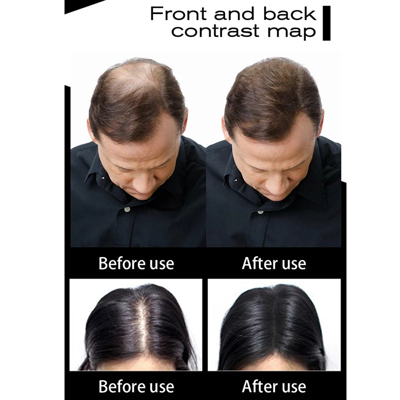 Recarga de Fibras Capilares em Pó - Produto para Perda de Cabelo Unissex