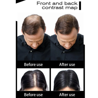 Recarga de Fibras Capilares em Pó - Produto para Perda de Cabelo Unissex